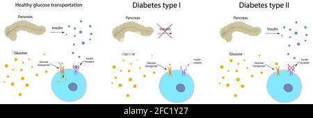 Diabete e metabolismo sano del glucosio, illustrazione Foto Stock