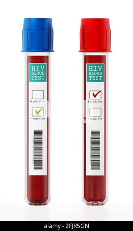Campioni di sangue positivi e negativi in fiale con etichette per test HIV. Illustrazione 3D. Foto Stock