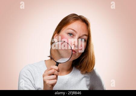 Ritratto di una donna che mostra arrossamento sulle guance, attraverso una lente di ingrandimento. Sfondo rosa. Il concetto di rosacea. Foto Stock