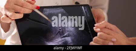 Medico che mostra foto di ultrasuoni con penna a sfera su digitale primo piano della compressa Foto Stock