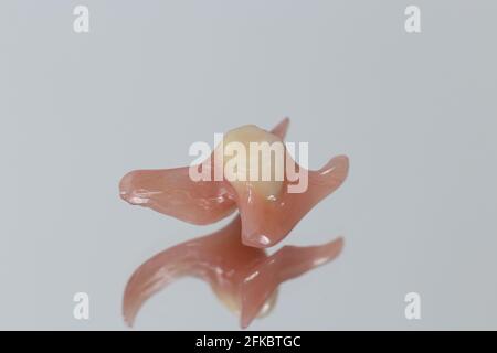 Protesi dentaria artificiale su sfondo blu. Singola protesi rimovibile per sostituire un dente reale, alternativa all'impianto dentale in den Foto Stock