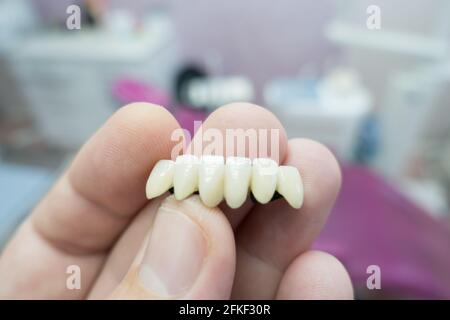 ponti dentali in ceramica metallica nelle mani di un medico Foto Stock