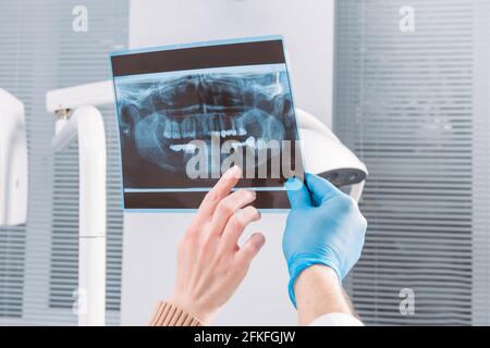Il medico mostra un'immagine radiografica per il paziente. Primo piano. Le mani del medico nei guanti trattengono l'immagine radiografica della mascella del paziente Foto Stock