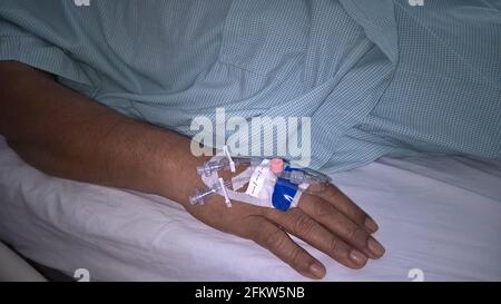 mano con cannule o cateteri endovenosi periferici Foto Stock
