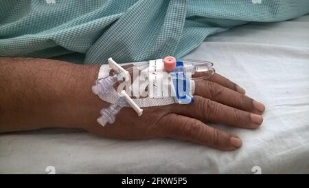 mano con cannule o cateteri endovenosi periferici Foto Stock