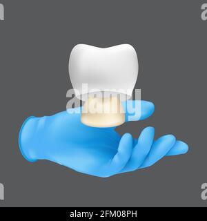 Mano dentista che indossa guanto chirurgico protettivo blu che tiene un modello ceramico del dente. illustrazione vettoriale 3d realistica di un concetto di corona sui denti Illustrazione Vettoriale