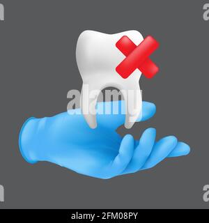 Mano dentista che indossa guanto chirurgico protettivo blu che tiene un modello ceramico del dente. illustrazione vettoriale 3d realistica del concetto di estrazione dei denti Illustrazione Vettoriale