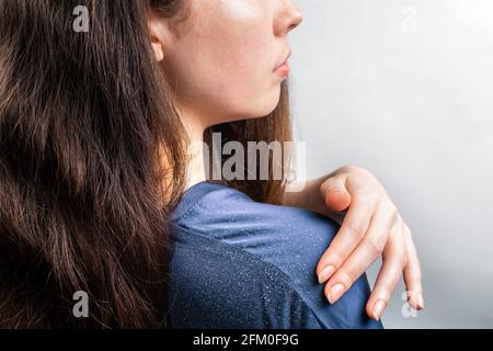 Una donna di brunette pennellerà la forfora con la mano. Primo piano della spalla. Sfondo bianco. Il concetto di forfora e pediculosi. Foto Stock