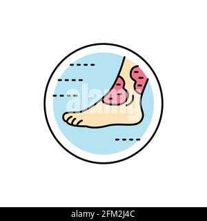 Icona della linea di colore della dermatite atopica. Malattia dermatologica. Elemento vettoriale isolato. Pittogramma per pagina web, app mobile, promo Illustrazione Vettoriale