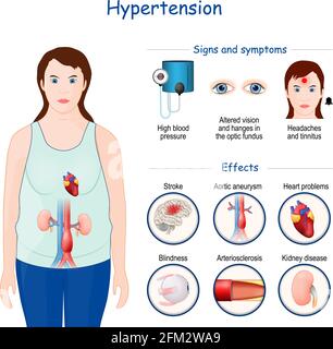 Ipertensione. Segni, sintomi ed effetti della pressione alta. Illustrazione vettoriale. Infografica Illustrazione Vettoriale