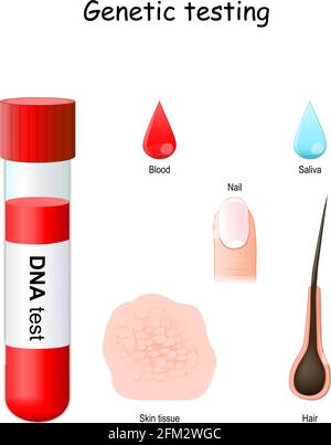 Test genetici. Provetta per analisi con sangue, gocce di saliva e sangue, capelli e dita con un'unghia. Comunemente utilizzato nei test del DNA (tessuto cutaneo, capelli, unghie) Illustrazione Vettoriale