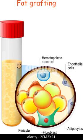 struttura di innesto del grasso. Provetta per analisi con grasso. Primo piano di adipociti, fibroblasti, periciti, cellule staminali endoteliali ed ematopoietiche. Vettore Illustrazione Vettoriale