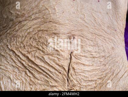 Un primo piano di rughe sulla pelle del ventre a causa della vecchiaia, la pelle si piega su un corpo femminile anziano. Foto Stock