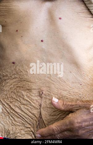 Un primo piano di rughe sulla pelle del ventre a causa della vecchiaia, la pelle si piega su un corpo femminile anziano. Foto Stock