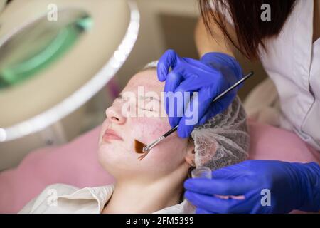 Cura del viso in clinica cosmetologica. Concetto di pelle sana. Young teen girl faccia vista angolo superiore primo piano. Il cosmetologo in guanti blu applica la maschera cosmetica per il trattamento dell'acne Foto Stock