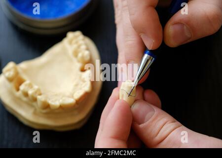 Il dentista è impegnato in una modellazione di protesi artificiali. Le mani di un tecnico odontoiatrico da vicino. Controllo di qualità del collo della t Foto Stock