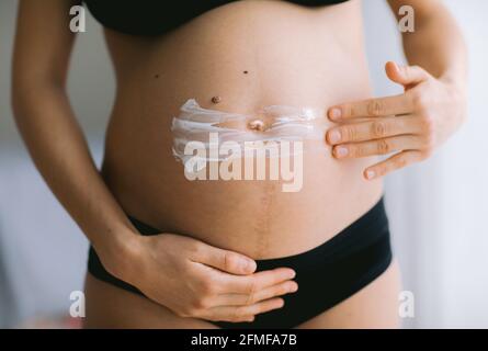 Donne incinte che mettono la crema anti stirata sul suo ventre. Cosmetici per idratare o idratare la pelle in gravidanza. Foto Stock