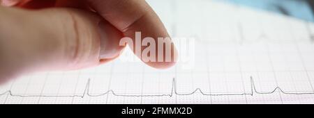 Pollice sopra la compressa con immagine del cardiogramma Foto Stock