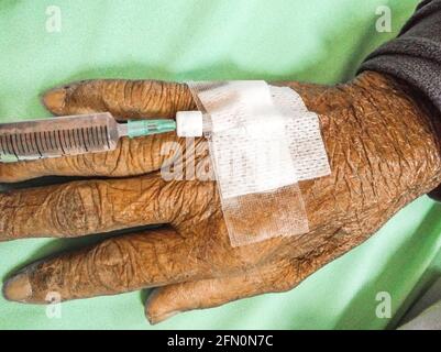 Siringa a pressione del medico nel tappo eparina paziente vecchio della mano, fuoco selettivo Foto Stock