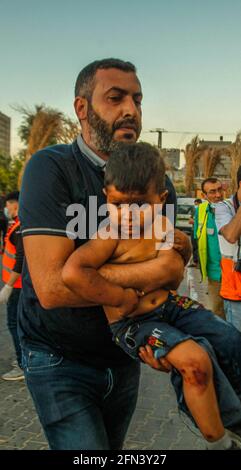 Gaza, Palestina. Maggio 13 2021: CONTENUTO GRAFICO - un bambino palestinese ferito viene portato all'ospedale di al-Shifa per ricevere cure dopo un attacco aereo israeliano nella città di Gaza. In risposta a giorni di violenti scontri tra le forze di sicurezza israeliane e i palestinesi a Gerusalemme, diverse fazioni militanti palestinesi a Gaza hanno lanciato attacchi razzi dal 10 maggio che hanno ucciso almeno sette israeliani fino ad oggi. Il ministero della salute della striscia di Gaza ha affermato che almeno 109 palestinesi, tra cui 28 bambini, sono stati uccisi durante i recenti rappresaglie israeliane. Credit: Abaca Press/Alamy Live New Foto Stock