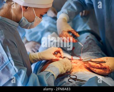 Primo piano del team medico in guanti sterili che posizionano suture dopo un intervento chirurgico di pancia. Chirurgo plastico che esegue chirurgia plastica addominale. Concetto di procedura di abdominoplastica e chirurgia estetica. Foto Stock