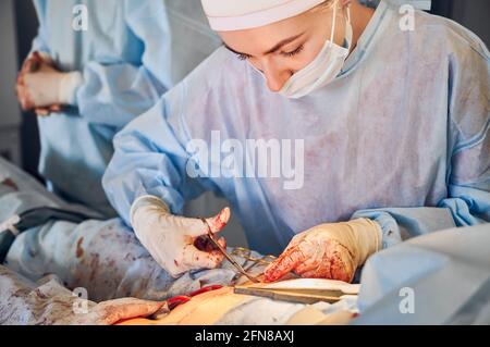 Primo piano di una giovane chirurgo femminile in guanti sterili taglio filo con forbici mentre si posiziona suture dopo un intervento di pancia tuck. Donna medico in uniforme chirurgica che esegue chirurgia plastica addominale. Foto Stock