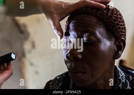 Un medico straniero sta esaminando gli occhi gialli di un paziente in una clinica medica a Mbale, Uganda orientale rurale Foto Stock