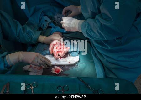 un medico esegue un intervento di chirurgia della mano Foto Stock