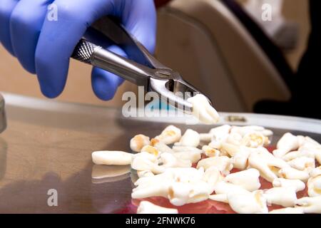 Dente tirato nella pinza metallica e un po' di sangue sul dente. Dentista la mano in gomma blu medica guanto con il forcipe. proprio dente estratto Foto Stock