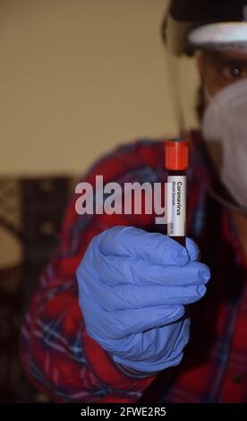 Esame del sangue di Covid - un infermiere di sesso maschile che mostra un campione di sangue di un paziente con sospetta corona o covid 19. Foto Stock