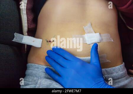 Esame del paziente da parte di un medico dopo la rimozione di l'appendice Foto Stock