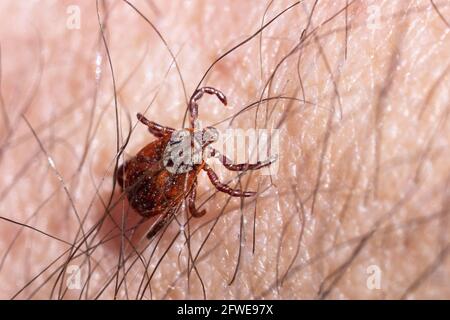 Acaro che succhia sangue su un macro della pelle umana Foto Stock