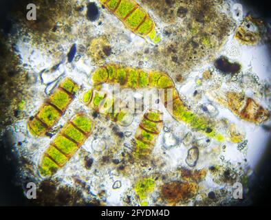 Microalghe al microscopio, campione prelevato dal muschio Foto Stock