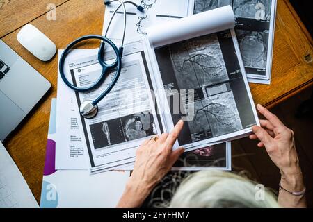 Angiogramma coronarico arteria affetta da stenosi. Foto Stock