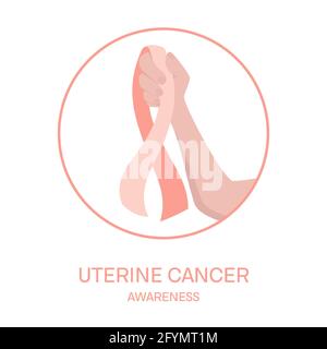 Cancro uterino, illustrazione concettuale Foto Stock
