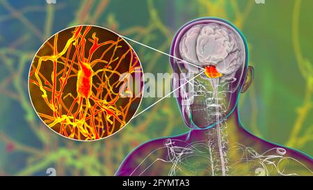 Cervello umano con pons e neuroni evidenziati, illustrazione Foto Stock