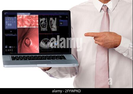 Medico che lavora con un notebook che mostra la colonografia TC o la scansione TC della vista assiale del colon rispetto alla vista coronale e l'immagine di rendering 3D sullo schermo . Ritaglio pa Foto Stock