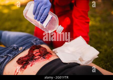 Il processo di trattamento della ferita con un antisettico. Lesioni alle ginocchia. Primo piano. Formazione di primo soccorso Foto Stock