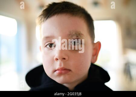 Povero ragazzo triste con sopracciglia tagliata in piedi in casa, concetto di povertà. Foto Stock