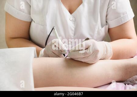 Specialista di epilazione dei capelli medico, epilazione elettronica dei capelli delle gambe della donna. Primo piano. Procedura di cosmetologia in cabina di bellezza. Foto Stock