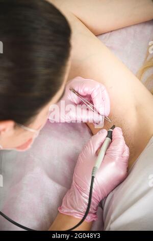 Il medico rimuove i capelli permanentemente nelle ascelle di una donna bionda usando l'epilazione elettronica del metod nel salone di bellezza di cosmetologia. Primo piano. Foto Stock