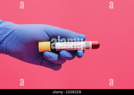 Mano del medico non riconoscibile tagliata che mostra un esame del sangue positivo di Coronavirus su sfondo rosa Foto Stock