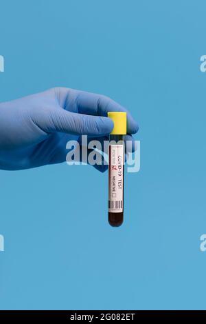 Mano del medico non riconoscibile tagliata che mostra un esame del sangue positivo di Coronavirus su sfondo rosa Foto Stock