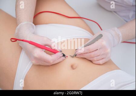 Donna in epilazione elettronica sulla pancia. Rimozione permanente dell'hardware dei peli addominali indesiderati. Foto Stock