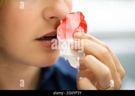 Donna cerca di fermare il sangue che fuoriesce dal naso Foto Stock