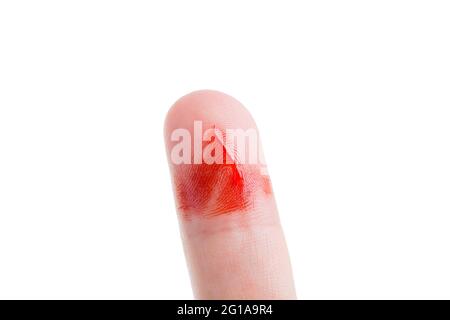 il dito umano è sporco in strisce di sangue con un taglio conseguenza di danni alla pelle e sanguinamento aperto da un graffio sul corpo della vittima primo piano iso Foto Stock