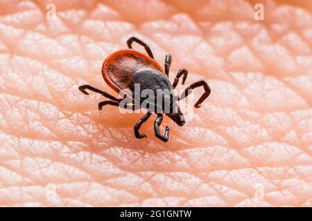 Encefalite infettiva Ixodes Scapularis o Persulcatus Deer Tick Insect sulla pelle. Encefalite virus o malattia di Lyme borreliosi infetta Ixodes Tick Foto Stock