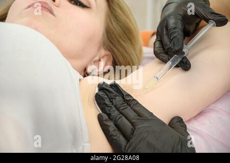 L'elettrologo medico effettua un'iniezione di anestesia nell'ascella prima della procedura di elettrolisi Foto Stock