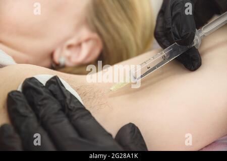 L'elettrologo medico effettua un'iniezione di anestesia nell'ascella prima della procedura di elettrolisi. Primo piano. Foto Stock