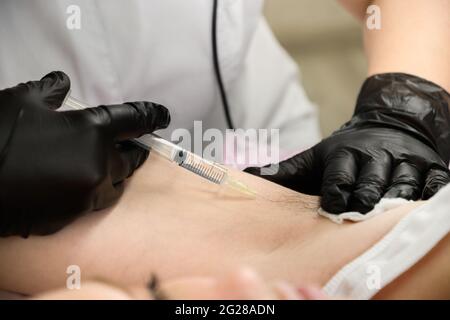 L'elettrologo medico effettua un'iniezione di anestesia nell'ascella prima della procedura di elettrolisi. Primo piano. Foto Stock